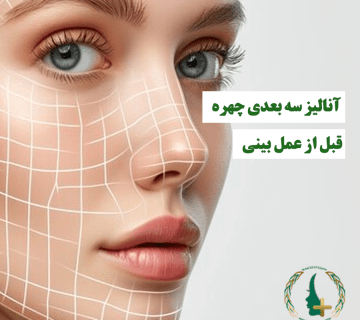 آنالیز سه بعدی چهره قبل از عمل بینی