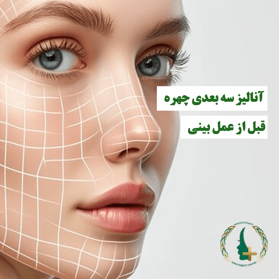 آنالیز سه بعدی چهره قبل از عمل بینی