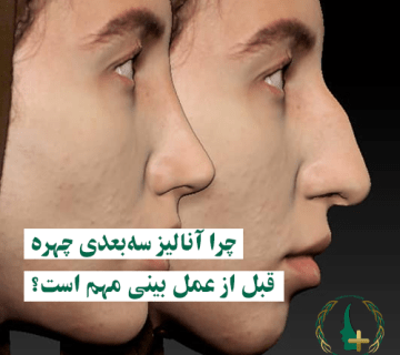 آنالیز سه بعدی چهره قبل از عمل بینی
