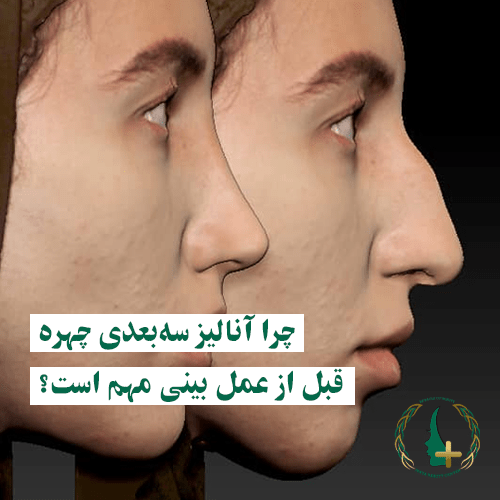 آنالیز سه بعدی چهره قبل از عمل بینی