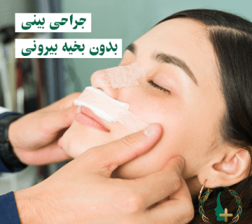 جراحی بینی بدون بخیه بیرونی