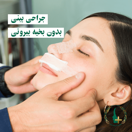 جراحی بینی بدون بخیه بیرونی