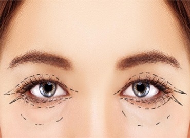 آنالیز غیرحضوری سه بعدی چهره