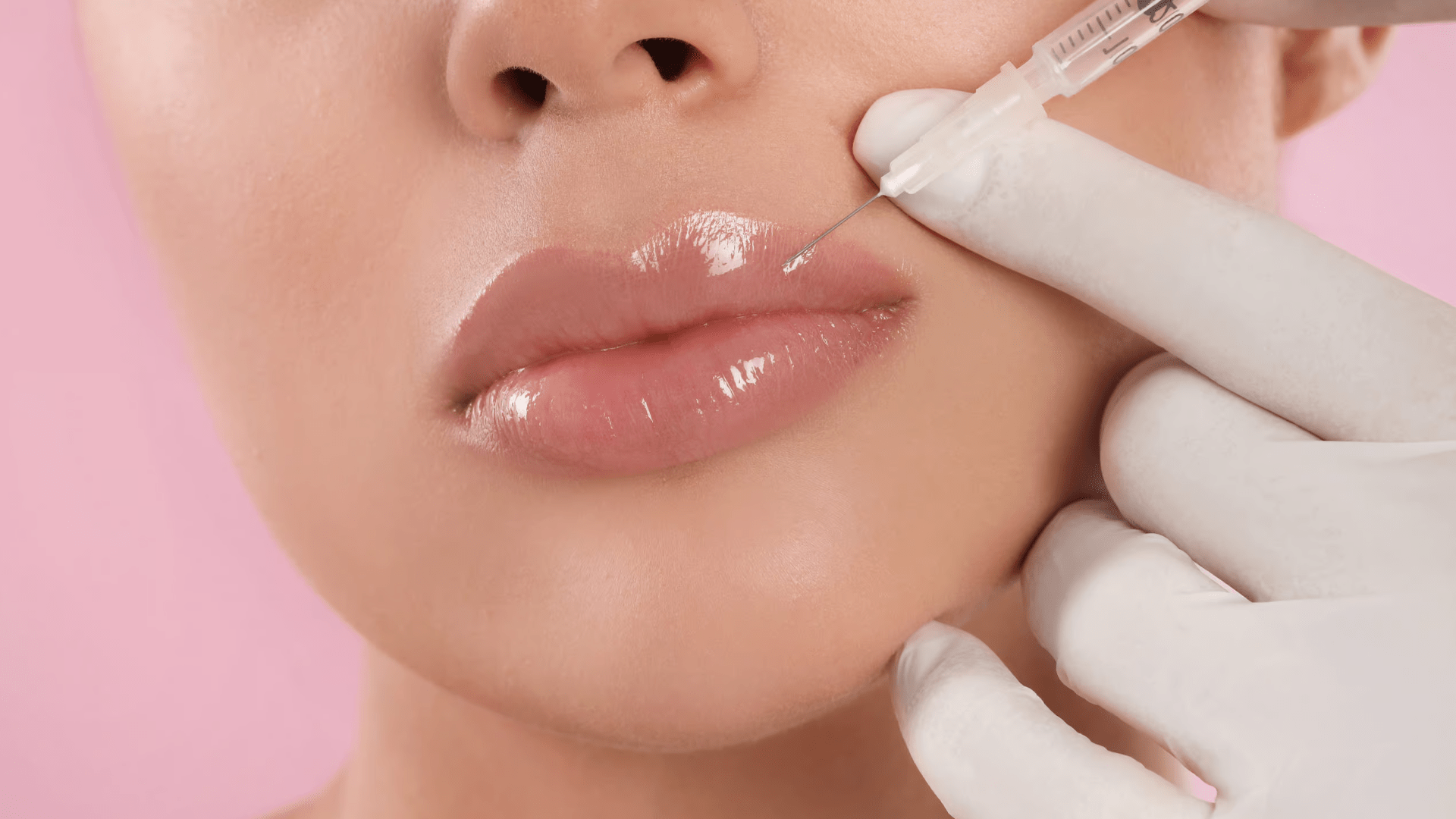 تزریق ژل لب