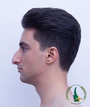 کاشت مو و ابرو با جدیدترین تکنولوژی‌های آنالیز سه‌بعدی در کلینیک زیبایی مایا