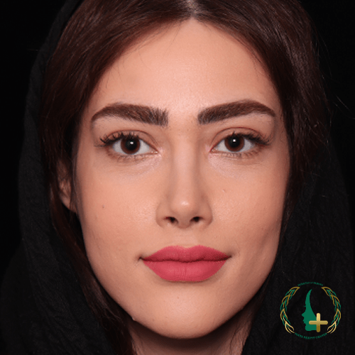 اولین کلینیک در استفاده از آنالیز سه‌بعدی چهره برای جراحی بینی بدون تامپون ، کلینیک زیبایی مایا