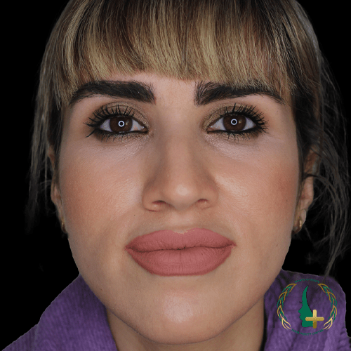 بهترین جراح ترمیم بینی با استفاده از آنالیز سه بعدی و تکنیک‌های بدون تامپون در مرکز زیبایی مایا