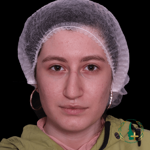 عمل بینی با نقاحت کمتر در کلینیک زیبایی مایا با آنالیز سه بعدی چهره