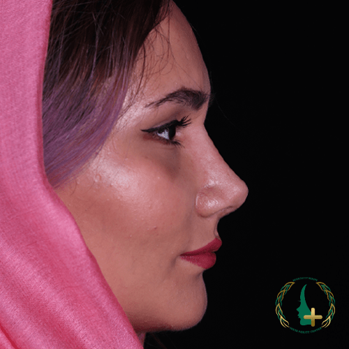 عمل بینی با روش‌های نوین و دقیق