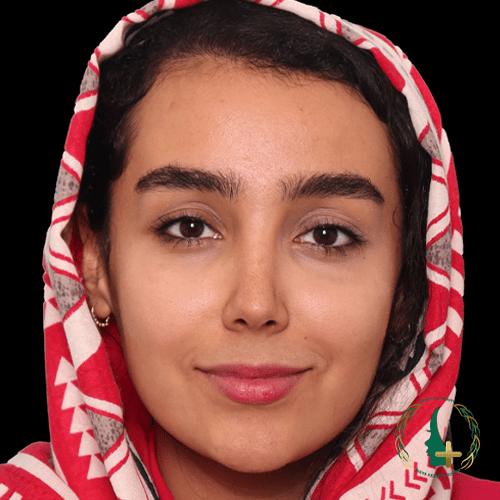 آنالیز سه بعدی چهره در جراحی بینی برای بهبود زیبایی و کاهش نقاحت در کلینیک زیبایی مایا