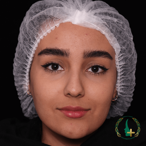 بهترین جراح ترمیم بینی با تخصص در آنالیز سه بعدی چهره و تکنیک‌های کم‌تهاجمی در کلینیک زیبایی مایا