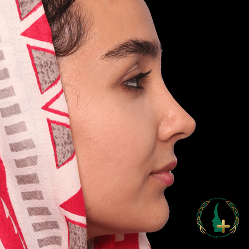 جراح ترمیم بینی با تکنیک‌های مدرن در کلینیک زیبایی مایا