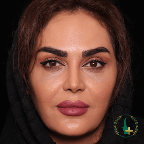 کلینیک زیبایی مایا با استفاده از تکنیک‌های پیشرفته مانند آنالیز سه‌بعدی چهره، عمل بینی بدون تامپون را انجام می‌دهد