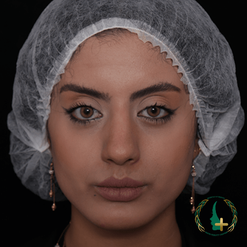 کلینیک زیبایی مایا، مرکز تخصصی جراحی بینی بدون نقاهت و تامپون با بهترین جراحان