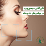 جراحی‌های فک و چانه