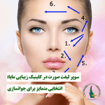 سوپر لیفت صورت