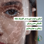 اسکن و لیفت