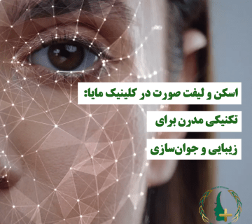 اسکن و لیفت