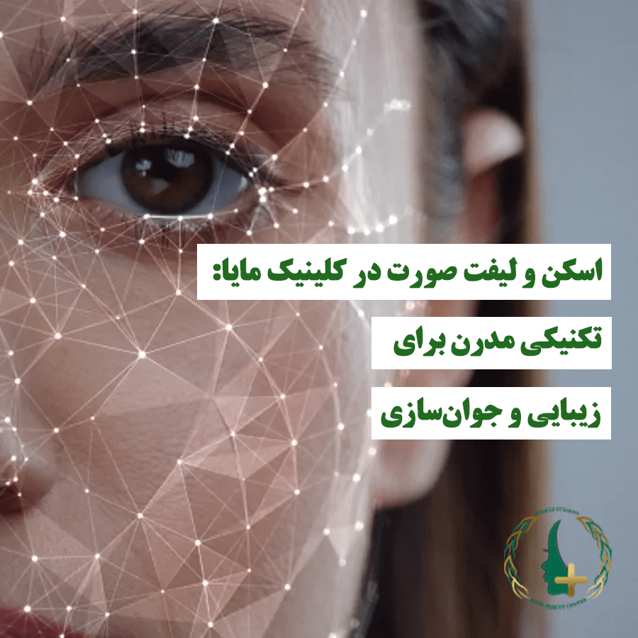 اسکن و لیفت