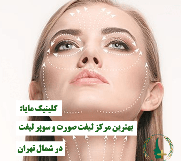 بهترین مرکز لیفت صورت و سوپر لیفت در شمال تهران