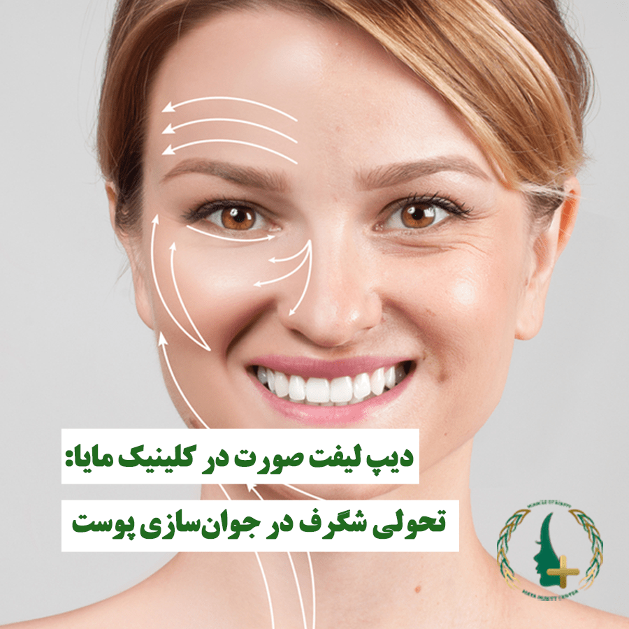 دیپ لیفت صورت در کلینیک مایا