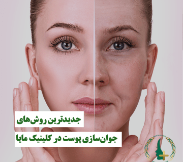 جدیدترین روش‌های جوان‌سازی پوست