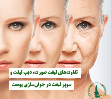 لیفت صورت، دیپ لیفت و سوپر لیفت در جوان‌سازی پوست