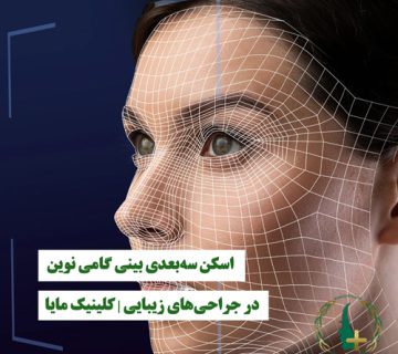 اسکن سه‌بعدی بینی گامی نوین در جراحی‌های زیبایی | کلینیک مایا