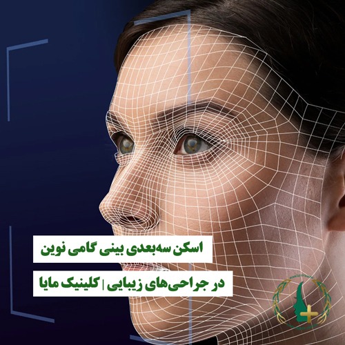 اسکن سه‌بعدی بینی گامی نوین در جراحی‌های زیبایی | کلینیک مایا