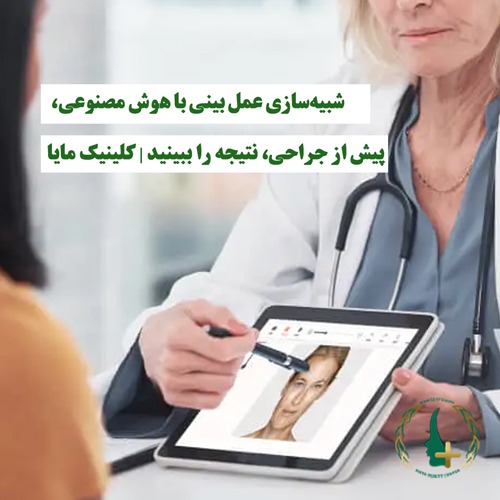 شبیه‌سازی عمل بینی با هوش مصنوعی، پیش از جراحی، نتیجه را ببینید | کلینیک مایا