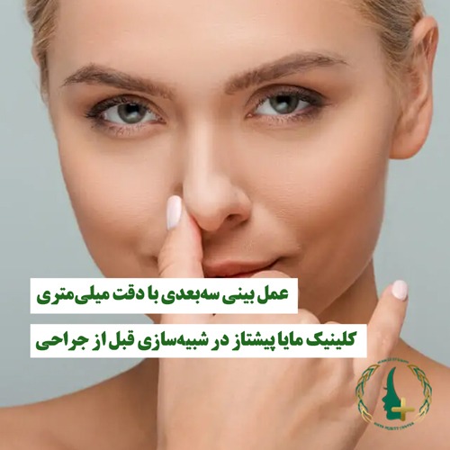 عمل بینی سه‌بعدی با دقت میلی‌متری | کلینیک مایا پیشتاز در شبیه‌سازی قبل از جراحی