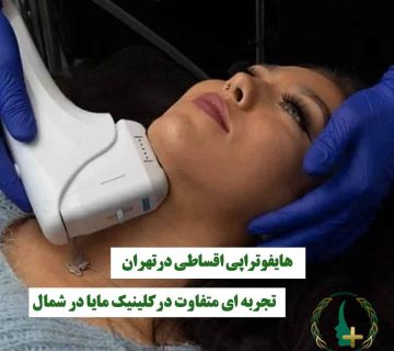 خانمی که روی صورتش هایفوتراپی انجام می‌شود، نماد هایفوتراپی اقساطی و تجربه متفاوت زیبایی در کلینیک مایا شمال تهران