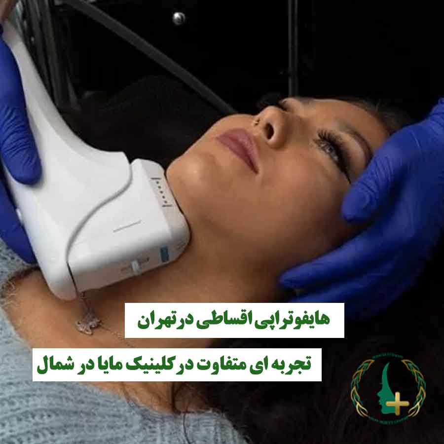 خانمی که روی صورتش هایفوتراپی انجام می‌شود، نماد هایفوتراپی اقساطی و تجربه متفاوت زیبایی در کلینیک مایا شمال تهران