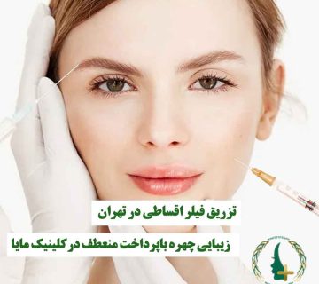 خانمی که تزریق فیلر روی صورتش انجام می‌شود، نماد تزریق فیلر اقساطی و زیبایی چهره با پرداخت منعطف در کلینیک مایا تهران