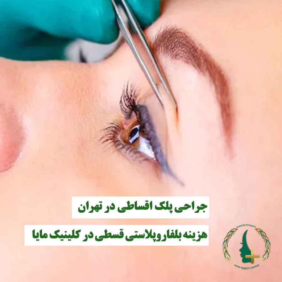 خانمی که توسط پزشک معاینه می‌شود، نماد خدمات جراحی پلک اقساطی و بلفاروپلاستی قسطی در کلینیک مایا تهران