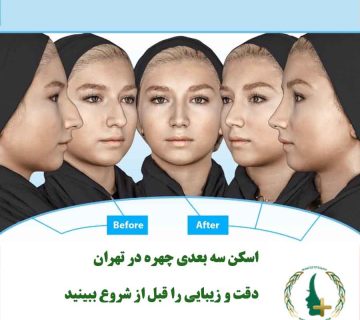 نمای قبل و بعد از اسکن سه‌بعدی چهره برای شبیه‌سازی عمل بینی در کلینیک مایا