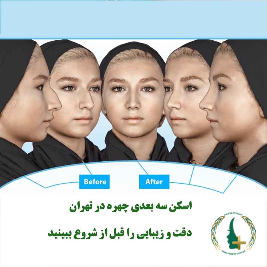 نمای قبل و بعد از اسکن سه‌بعدی چهره برای شبیه‌سازی عمل بینی در کلینیک مایا